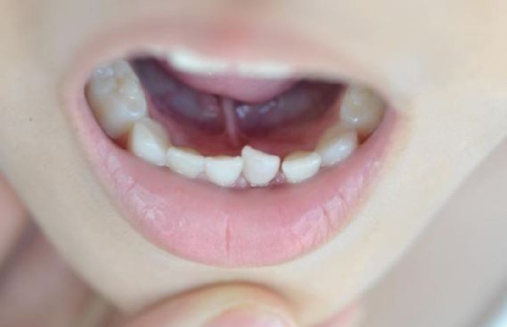 Voilà pourquoi il faut garder les dents de lait de vos enfants !