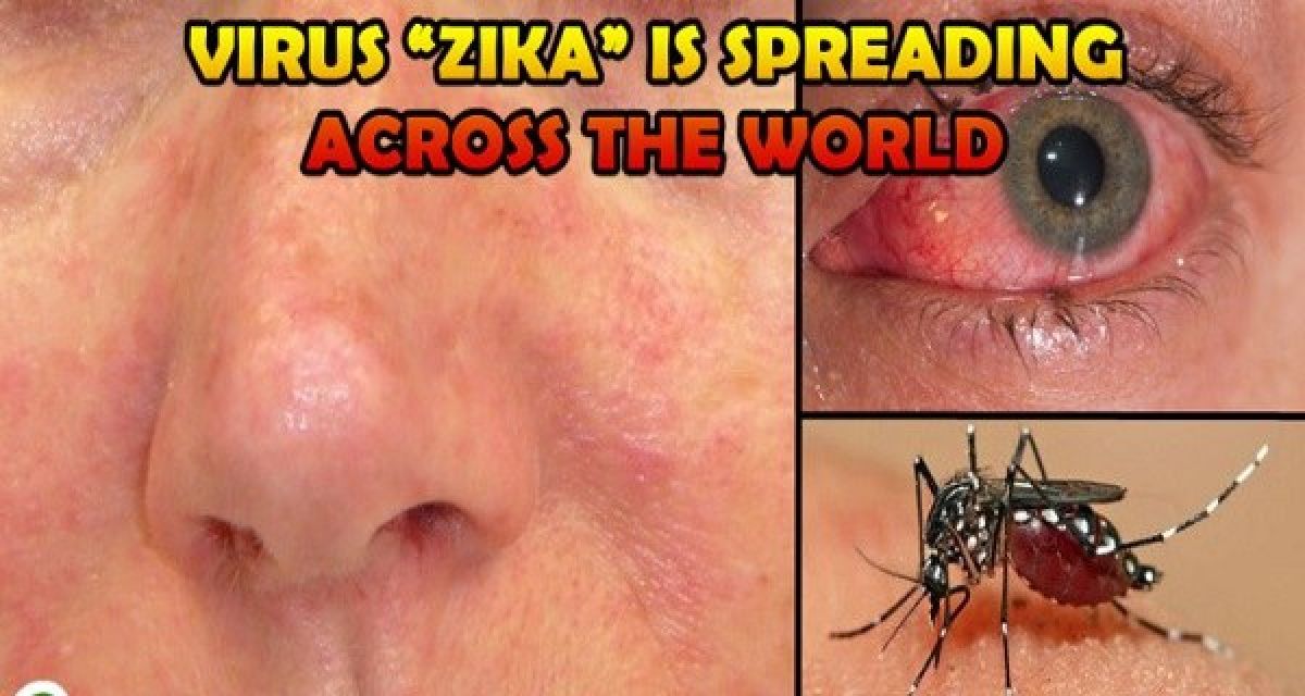Ce que vous devez savoir sur le nouveau virus mondial appelé « Zika »
